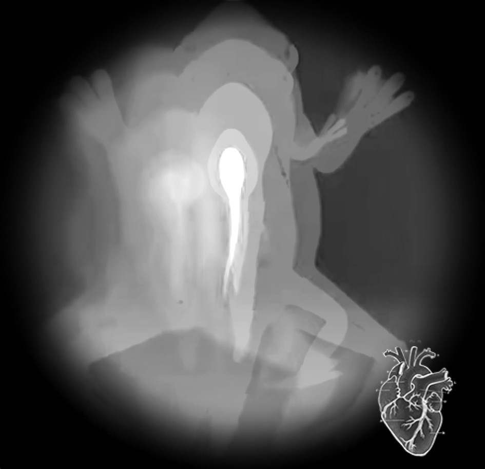 Lachlan Plain CHRYSALIS